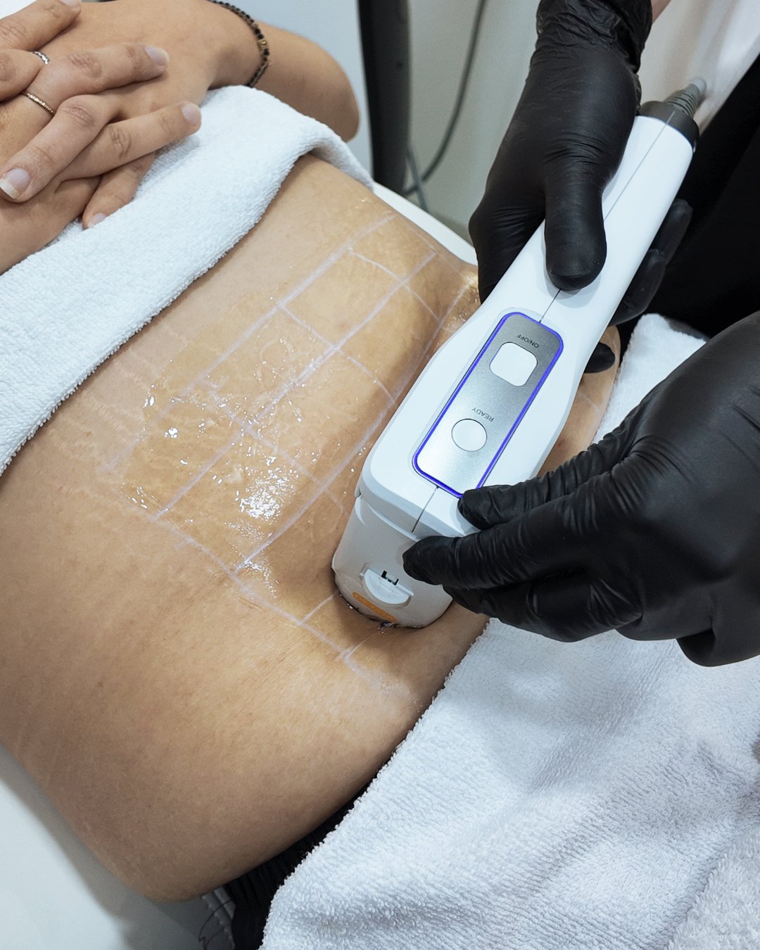 Body & Hair Treatment
