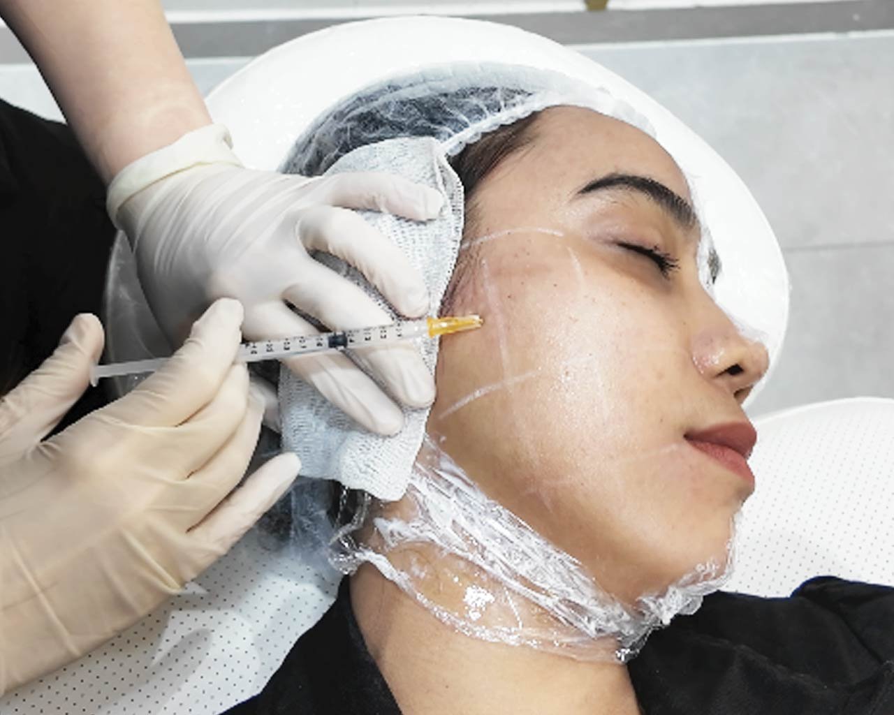 Collagen Replacement