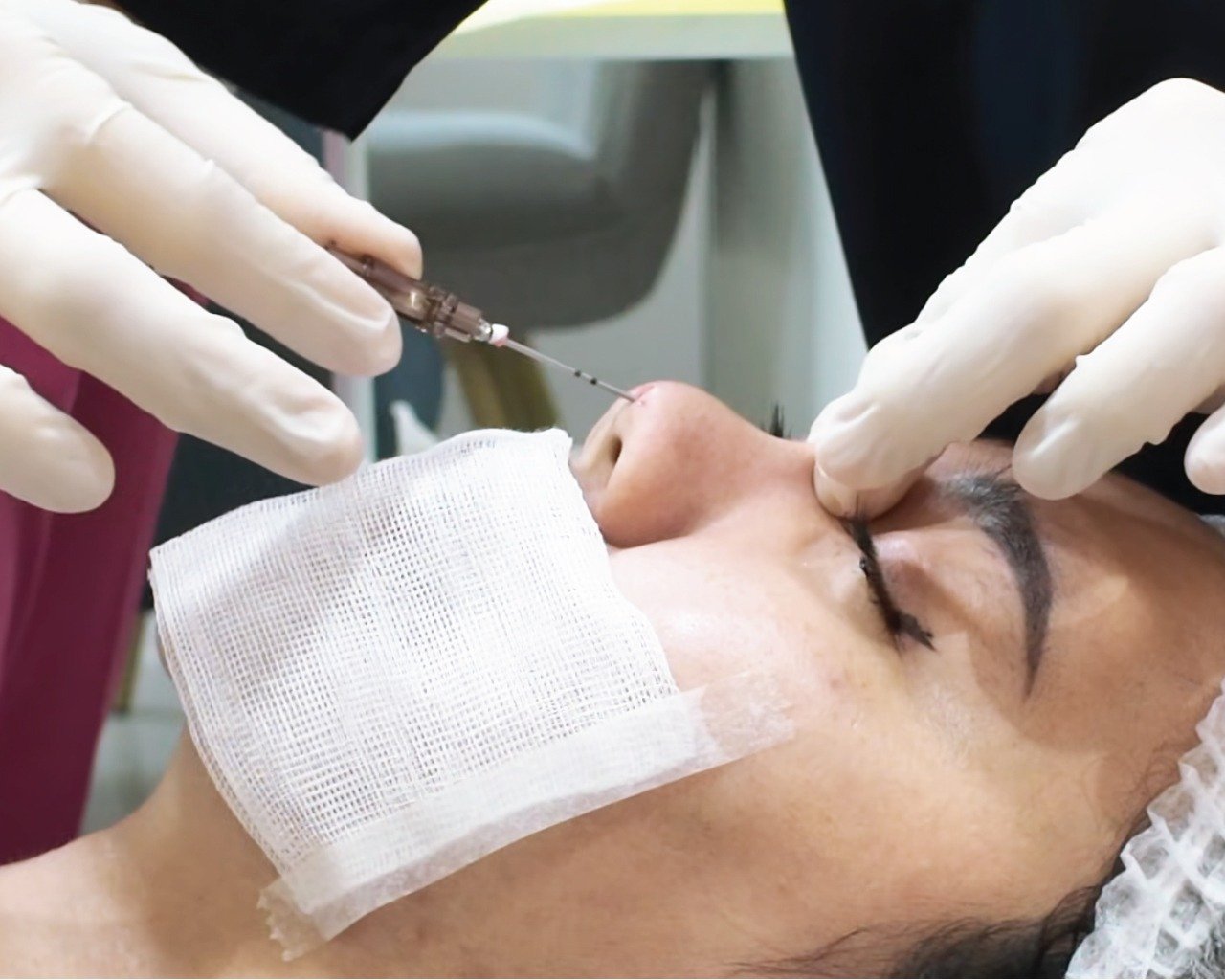 Korean Nose Lift