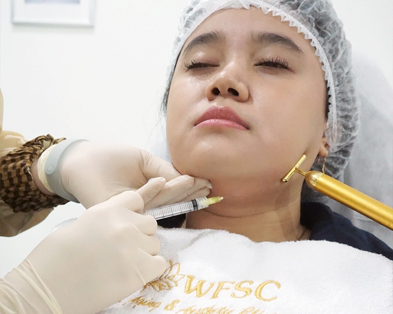 Mesolipolysis for Face